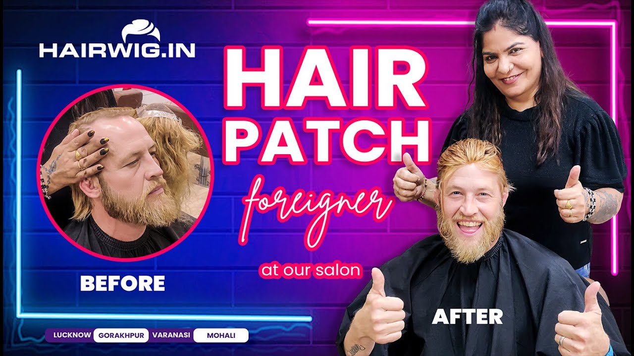 Hair Patch | Foreigner in Hairwig.in 