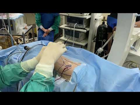 Kidney Stone Removal Uc San Diego Health Youtube