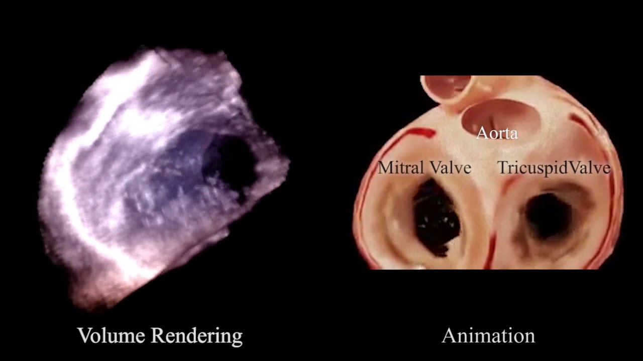 3D+Time Volume Render with Heart Animation - YouTube