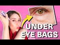 How To Get Rid Of Under Eye Bags &amp; Puffy Eyes! | Dr. Shereene Idriss