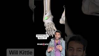 Can george Kittle play through his ankle injury? Sports doctor reviews #niners #fantasyfootball