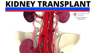Kidney Transplant Surgery & Evaluation Process