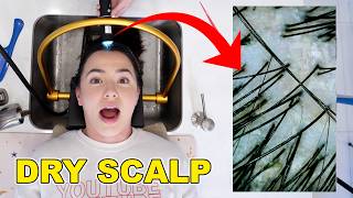 Trying The Viral Scalp Spa  Merrell Twins