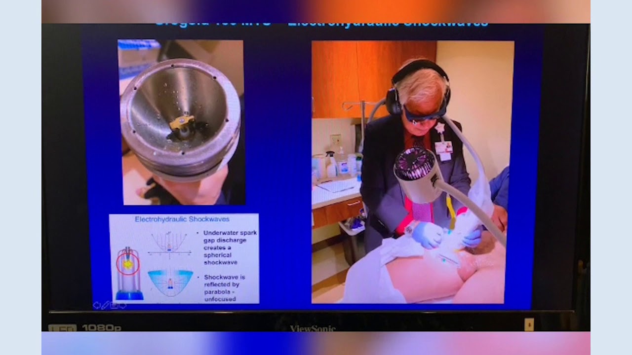 Shockwave therapy for ED - Dr  Goldstein Presentation June 2019