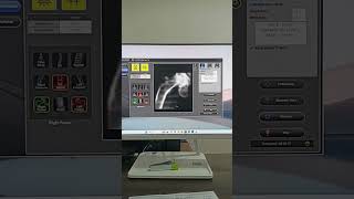 Three Side Dexa Scan