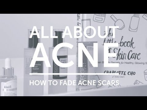 All About Acne: How To Fade Acne Scars with COSRX