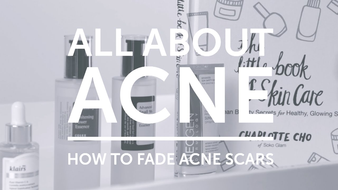 soko glam acne scars