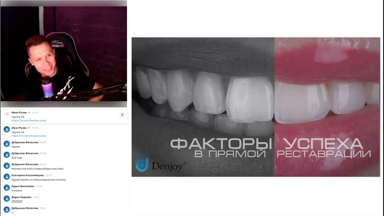 Иван Рузин: Факторы успеха в прямой реставрации 03.12.2023