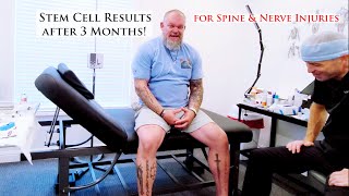 A Patient's Experience with Stem Cell Therapy Injections for Complex Spine Injuries - Testimonial