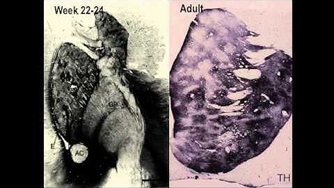 Repetitive Behaviors in Autism Spectrum and OC-Spectrum Disorders
