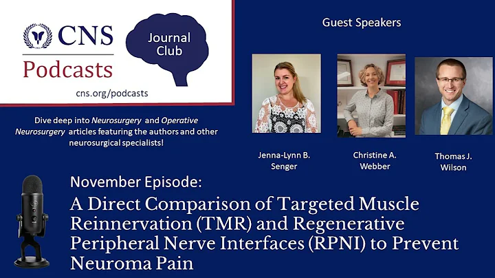 Journal Club Podcast: A Direct Comparison TMR and RPNI to Prevent Neuroma Pain