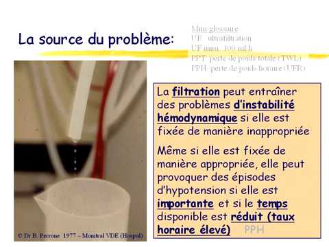 Vidéo: IHDIP: Un Essai Contrôlé Randomisé Pour évaluer La Sécurité Et L'efficacité De L'hémodialyse Incrémentale Chez Les Patients Incidents