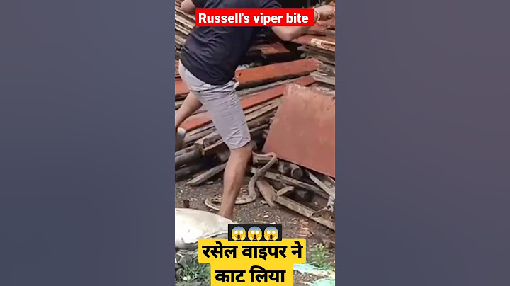 লাইভ রাসেল ভাইপার সাপের কামড় #shorts #youtubeshorts #viralvideo