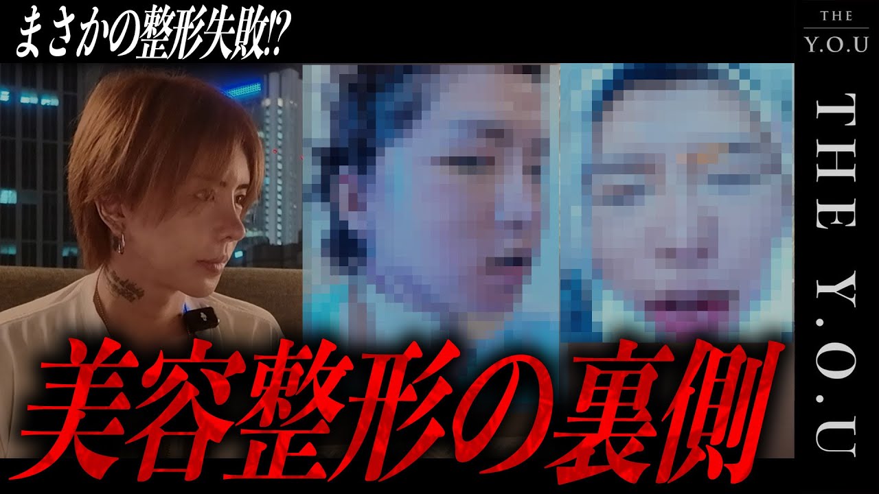 【壮絶な整形を全公開】カッコよく居続けるためには整形は必要。