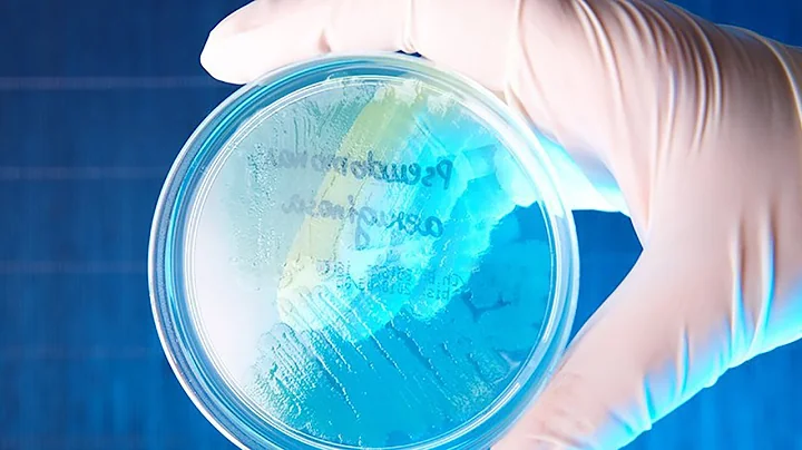 Antibiotic resistance and the rise of the 'superbug'