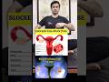 Best Exercise for Blocked Fallopian Tube #shorts #tranding
