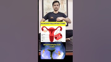 Best Exercise for Blocked Fallopian Tube #shorts #tranding