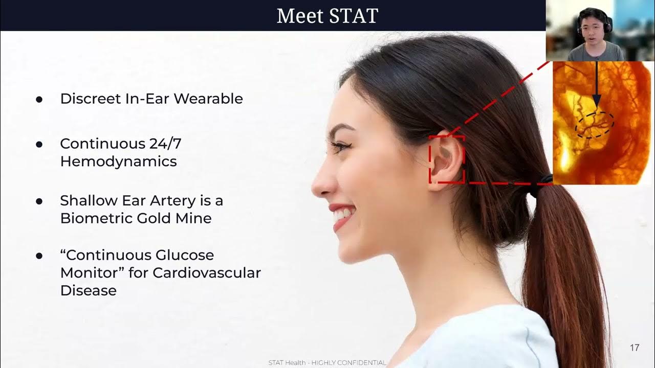 STAT Health launches first in-ear wearable to measure blood flow - Medical  Device Network