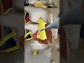 Lumbar disectomy procedure 3D Animation#spineproblem#slipdisc #discsurgery #spinesurgery  #medical3d