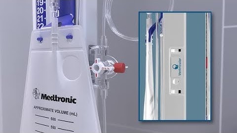 Duet In-Service Animation