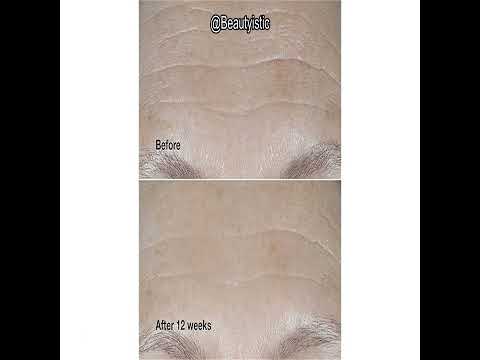 Clinique Smart Clinical Repair Review: Does This SPF 30 Cream Really Fight Wrinkles?