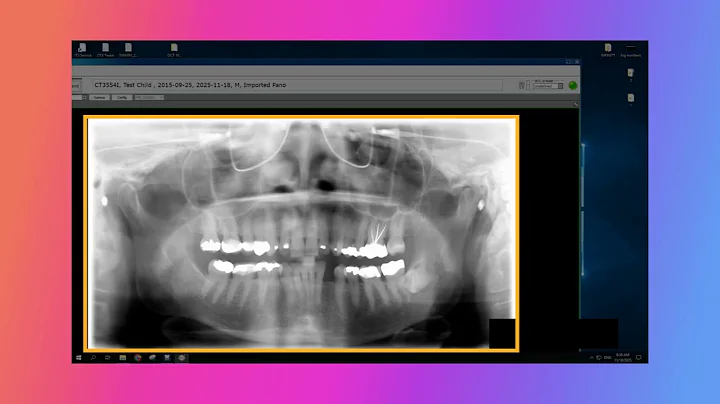 Import Pano Efficiently Into INFINITT