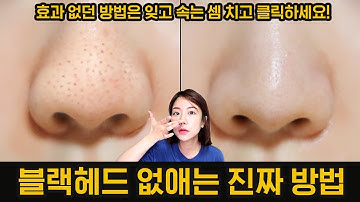 ENG) 블랙헤드 없애는방법🔍(더보기란필독) 지금까지 봤던 제거 영상은 잊고! 믿고! 들어오세요! 제가 없애드릴게요🧐 How to remove blackheads