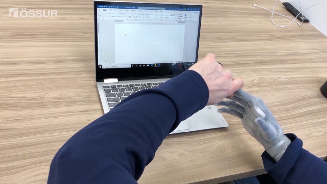 Typing - Transradial