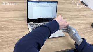 Typing - Transradial