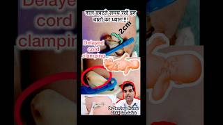 नवजात की नाल काटते समय ये गलतियाँ कभी न करें! 👶✂️ #NewbornCare #UmbilicalCord #shorts #explore