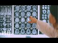 First-ever recording of a dying human brain reveals what happens right before death | PHJ