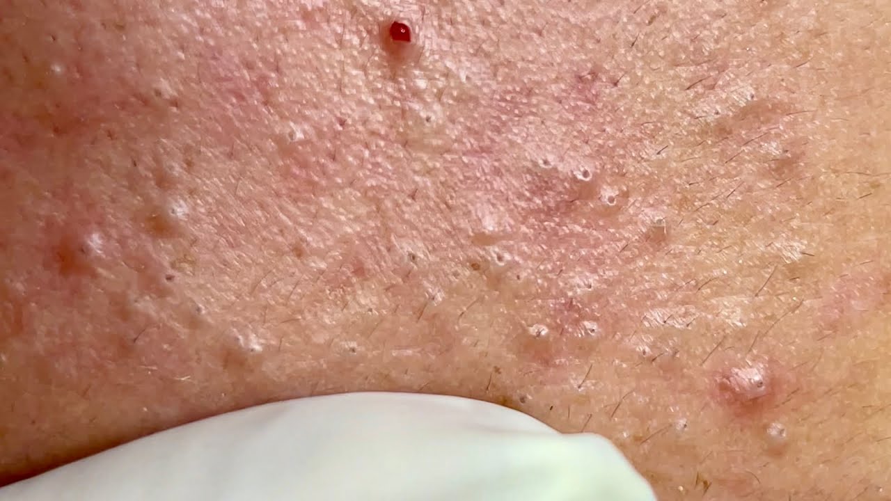 Satisfying video with Chung Vo Spa | 238