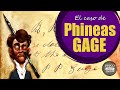 ✔️ El Alucinante Caso de Phineas Gage · Lo que nos Enseña del Funcionamiento del Cerebro · PSYconoce