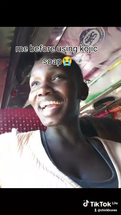 kojie san review  before and after use