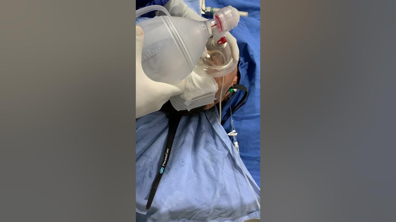 Intubation in ICU How is it done ? YouTube