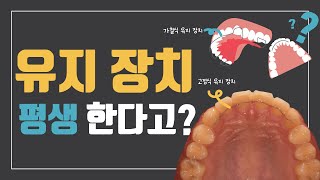 [프라임S] 유지 장치 평생 해야 하나? 🦷 언제까지 해야 하지?..