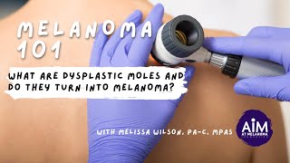 What are Dysplastic Moles and Do They Turn into Melanoma?