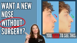 Transform Your Nose In 10 Minutes With Zero Downtime - The Liquid Rhinoplasty Secret