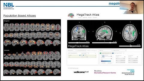 2 Inleiding tot diffusietractografie