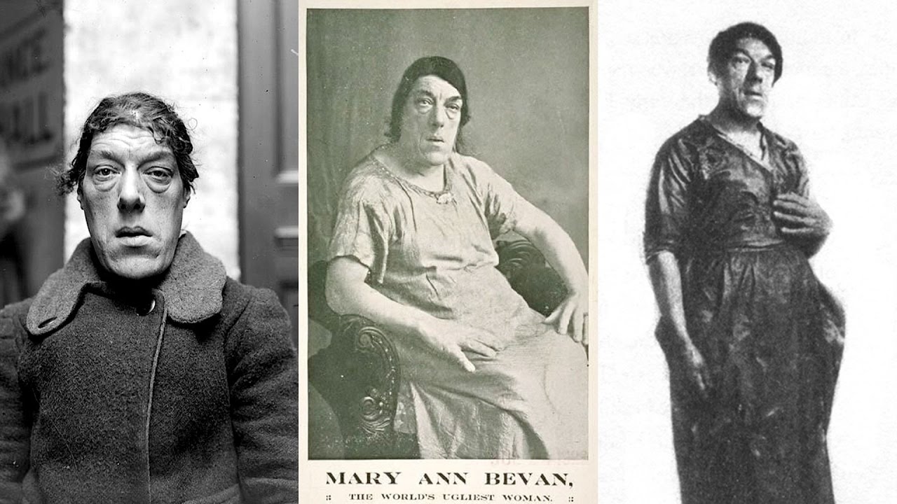 Mary Ann Bevan, a mulher mais feia do mundo que tinha uma alma