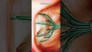 How Tonsillectomy Surgery Is Done (3D Animation)