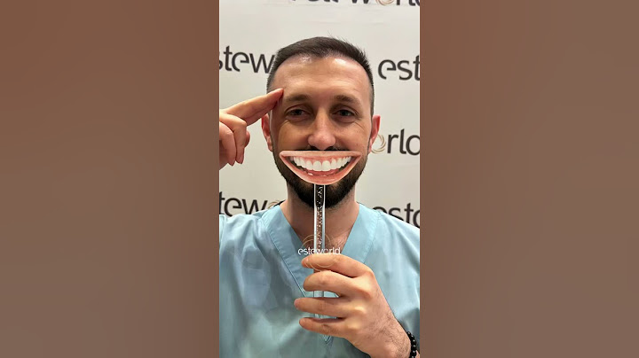 #esteworld #botox #beauty #dental #dentist #dentalcare
