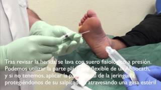 Herido pie curar como un