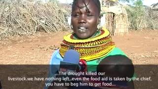 Baragoi Children suffer Kwashiorkor and Marasmus