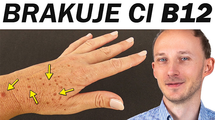 Gdy masz niedobór B12, na skórze i ustach pojawi się to