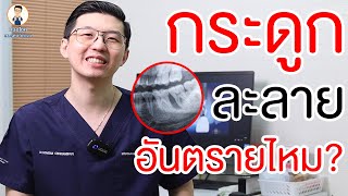 ปลูกกระดูกไปแล้วมีเกล็ดขาวๆ ออกมาเป็นอันตรายไหมปกติหรือป่าว ? | คลายปัญหาฟันกับหมอโชค