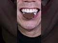ASMR | Chocolate Coin CRUNCH! 🪙🍫 #DoctorTristanPeh #ASMR