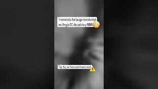 Este Hallazgo No Lo Esperábamos