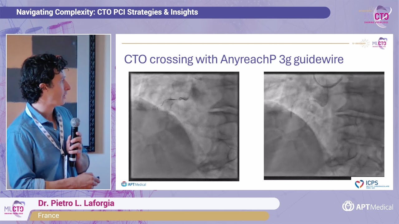 How to deal with calcified and tortuous CTOs? - Dr. Pietro L. Laforgia (France)