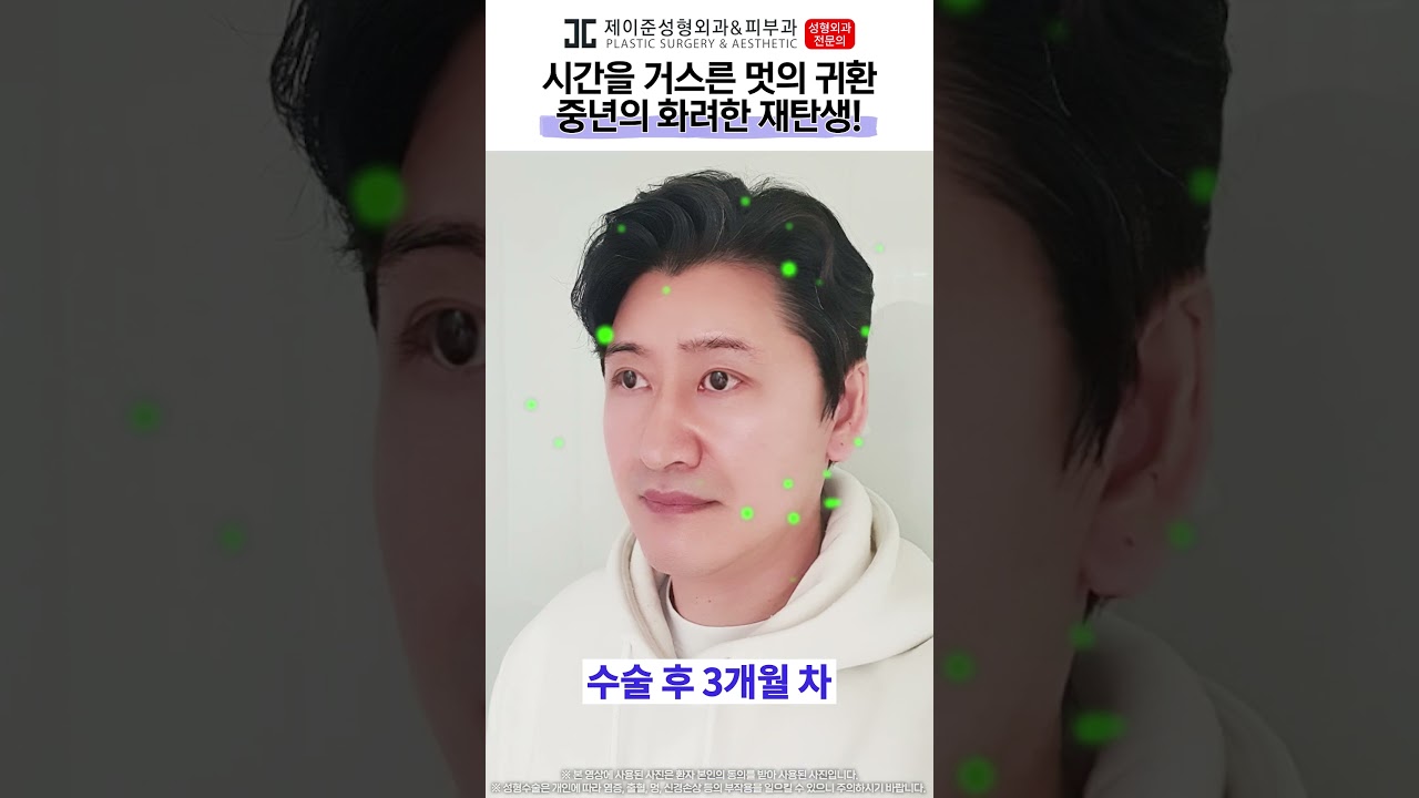 [Bệnh viện Thẩm mỹ & Da liễu Jayjun] Từ quý ông trung niên trở thành oppa ấm áp~! Hiệu quả của phẫu thuật nâng cơ mặt giúp trẻ hóa 10 tuổi!!